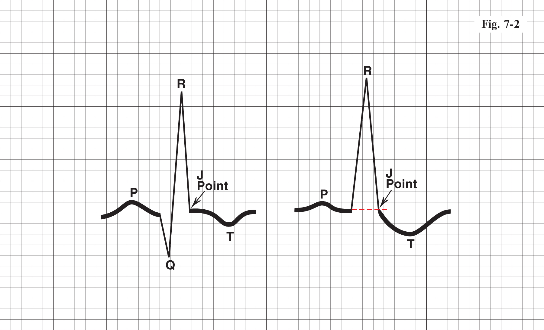 A978-1-84882-778-3_7_Fig2_HTML.jpg