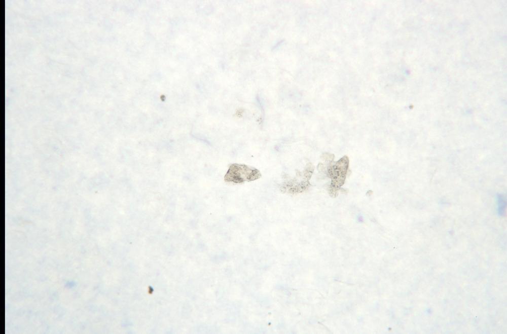 Unstained squamous epithelial cells, 100X