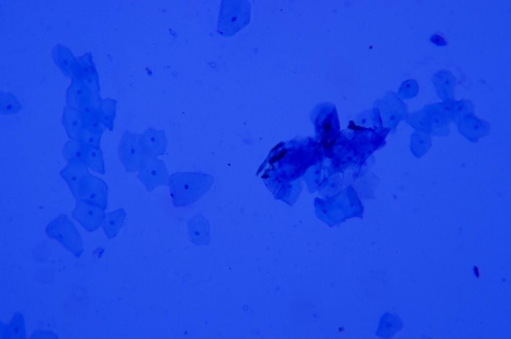 Squamous epithelial cells stained with methylene blue, 100X