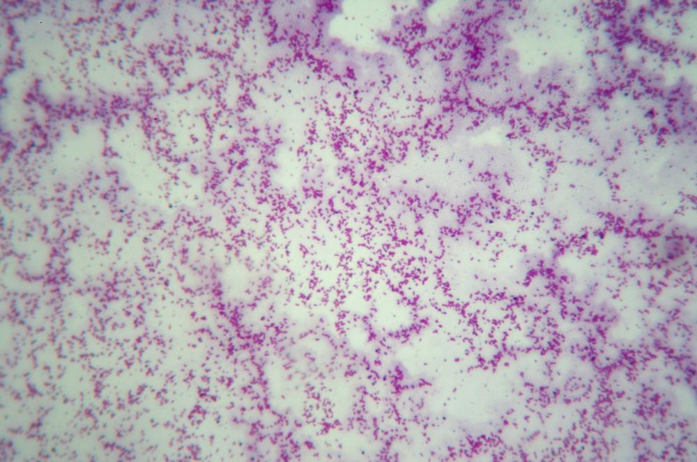 Gram-negative bacilli, 400X