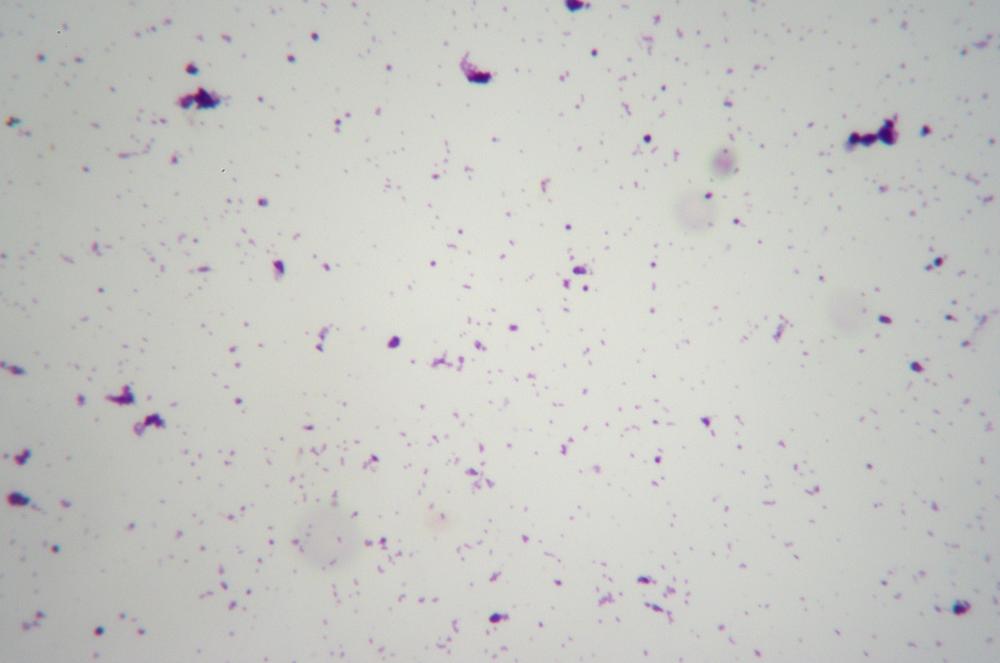 Gram-positive cocci, 400X