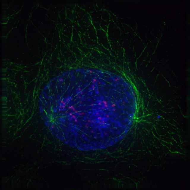 Prophase of mitosis