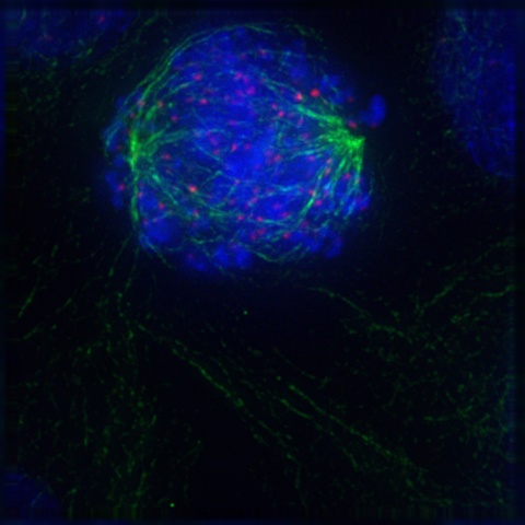 Prometaphase of mitosis