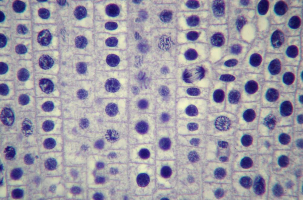 Onion (Allium sp.) root tip sec mitosis, 400X (a)