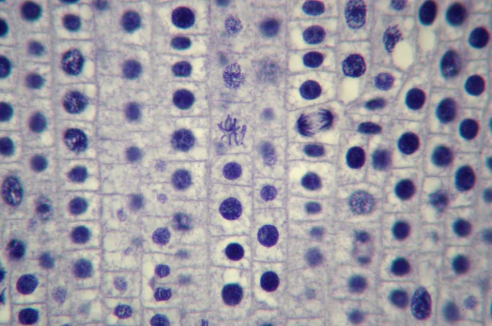 Onion (Allium sp.) root tip sec mitosis, 400X (b)