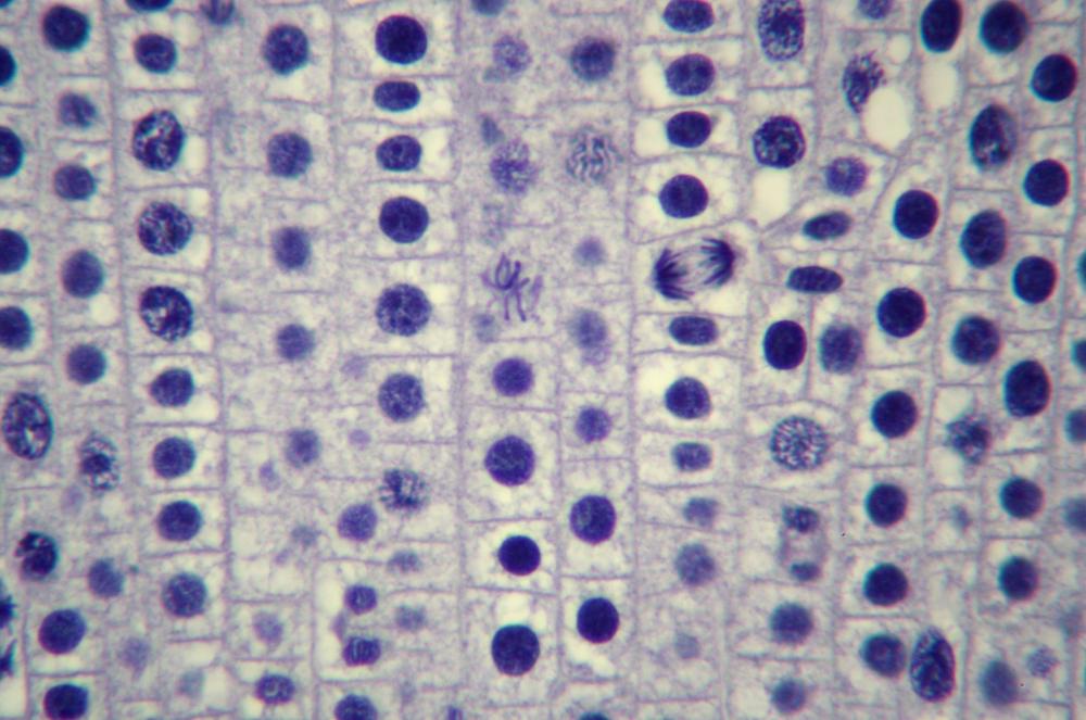 Onion (Allium sp.) root tip sec mitosis, 400X (c)