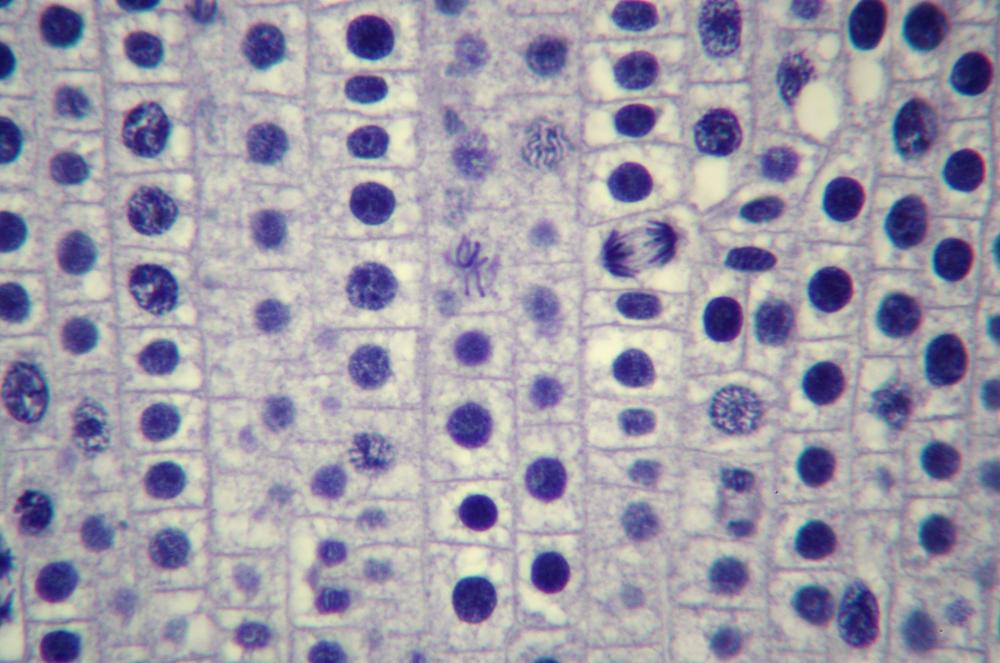 Onion (Allium sp.) root tip sec mitosis, 400X (d)