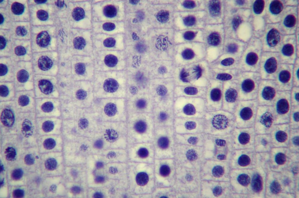 Onion (Allium sp.) root tip sec mitosis, 400X (e)