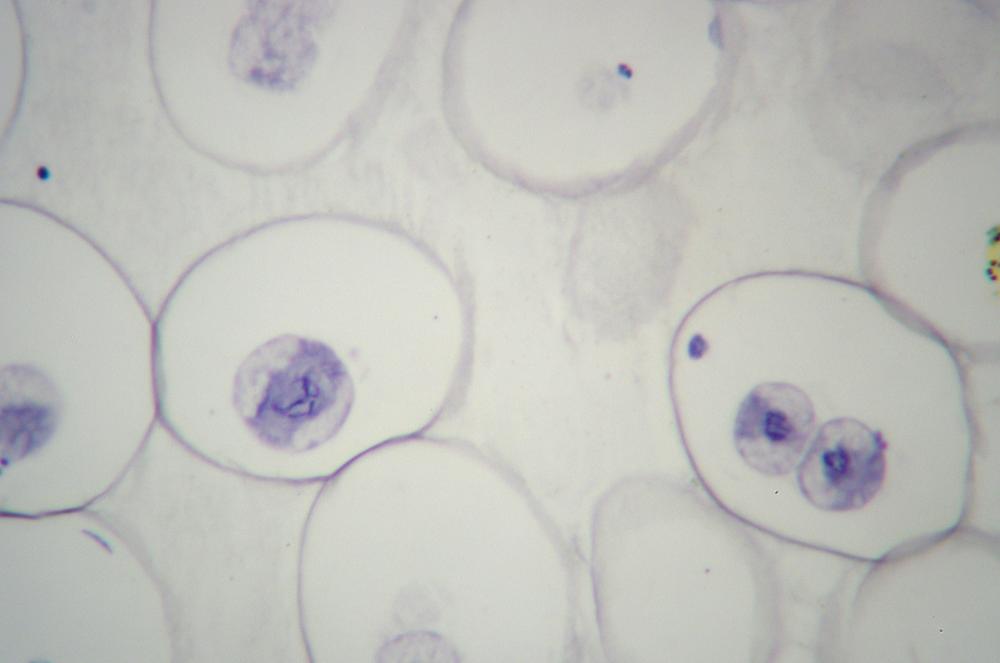 Roundworm (Ascaris sp.) egg sec mitosis, 400X