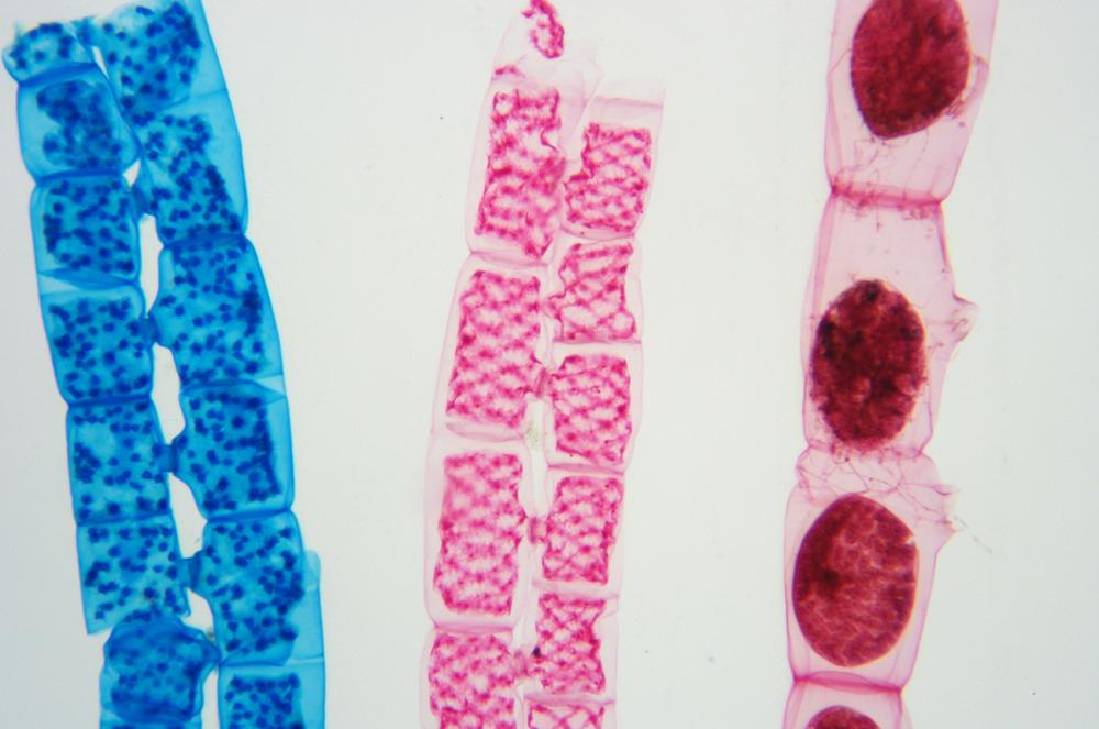 Spirogyra in scalariform conjugation, 100X