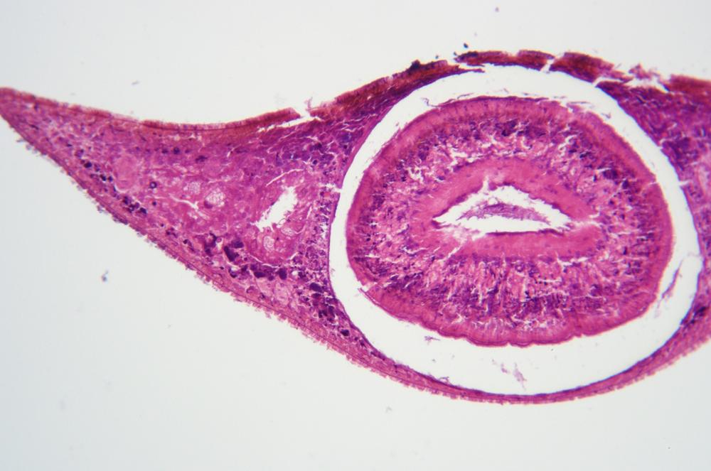 Planaria pharynx region cs, 100X