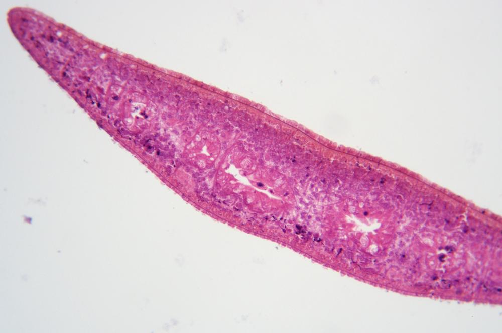 Planaria posterior region cs, 100X