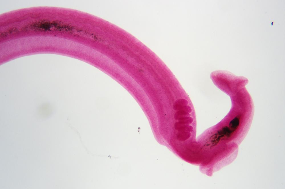 Blood fluke (Schistosoma mansoni) male wm, 40X