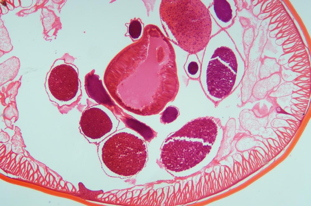 Roundworm (Ascaris lumbricoides) cs, 40X