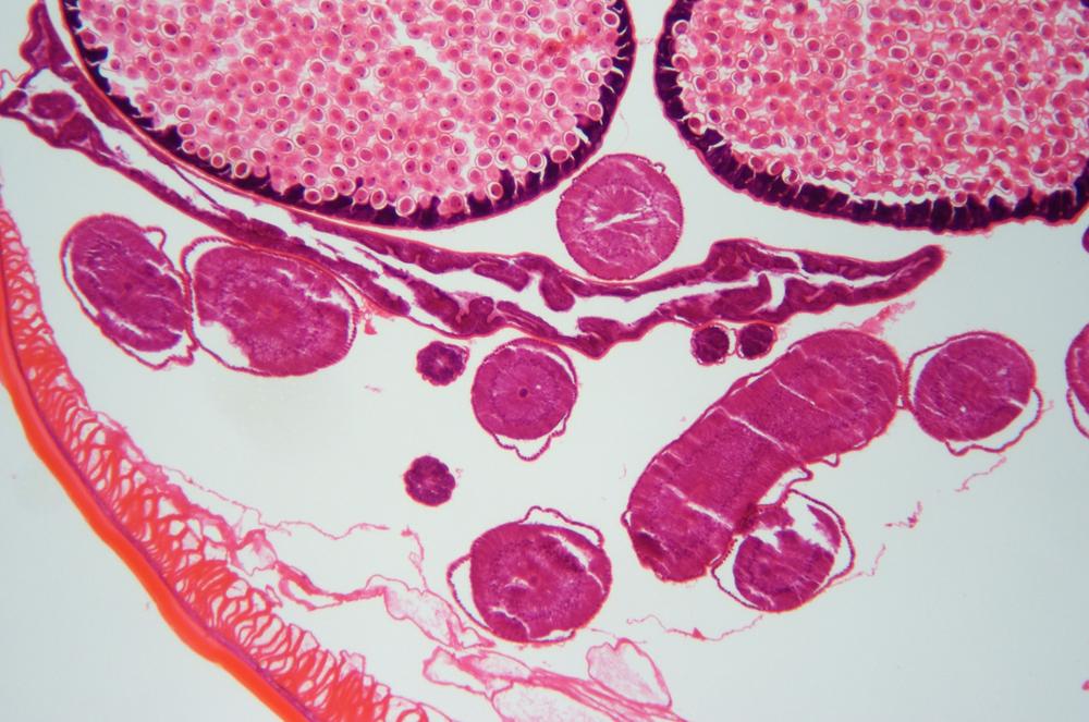 Roundworm (Ascaris lumbricoides) cs, 40X