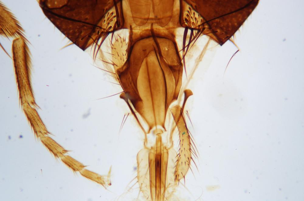 Housefly (Musca domestica) head and leg detail wm, 40X