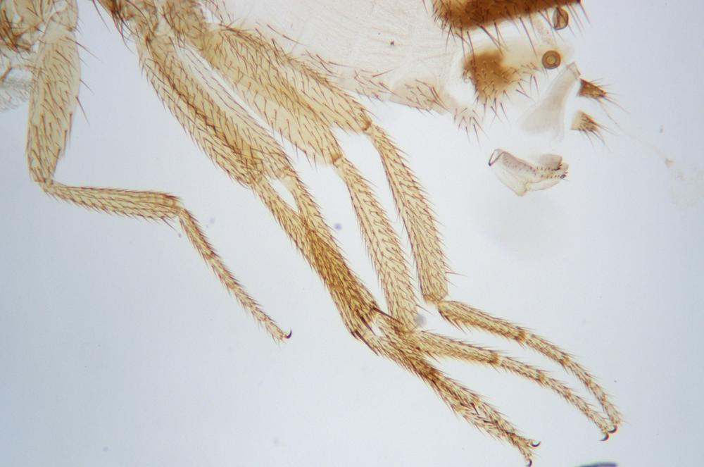 Fruit fly (Drosophila melanogaster) legs wm, 40X