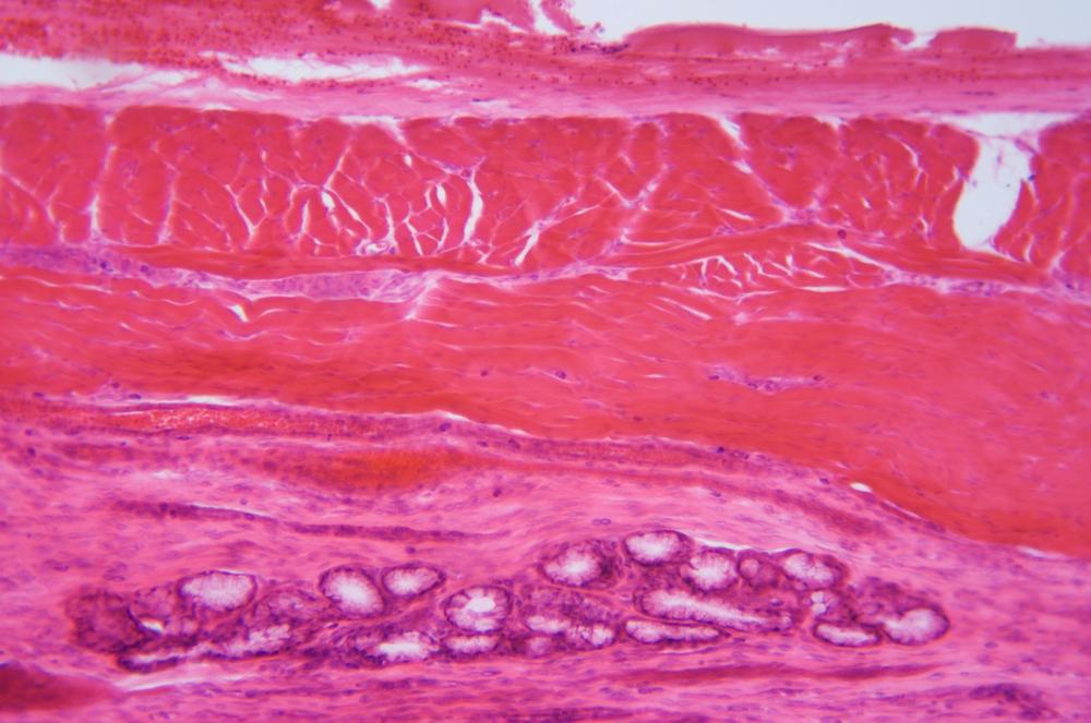 Flat stratified epithelium sec, 100X