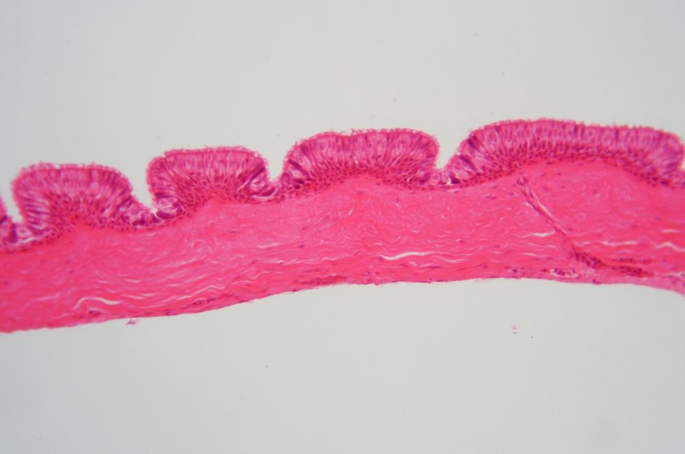 Ciliated epithelium sec, 100X