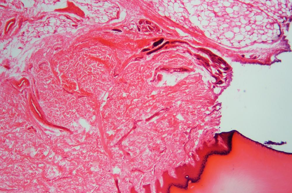 Human (Homo sapiens) skin sec through sweat gland, 40X