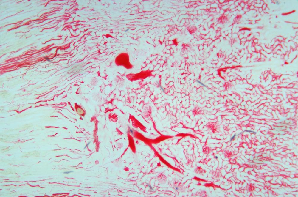 Kidney (dye-injected) cs, 40X