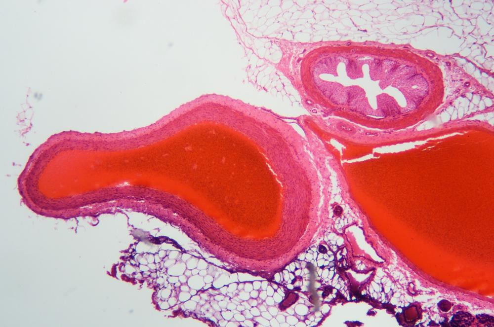 Artery and vein cs showing loose CT and adipose CT, 40X