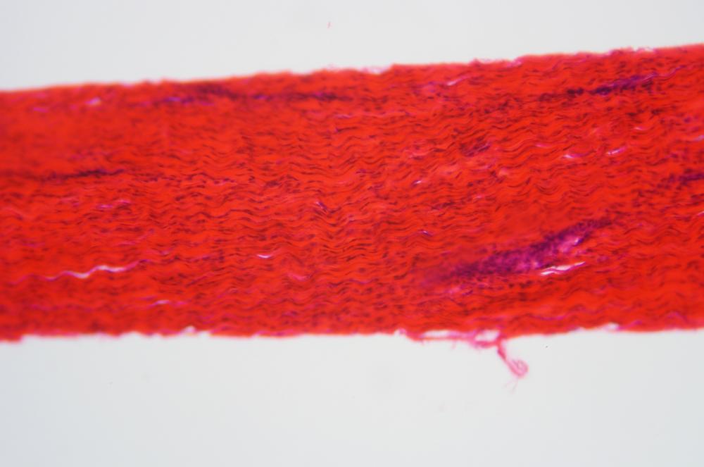 Dense connective tissue wm, 100X