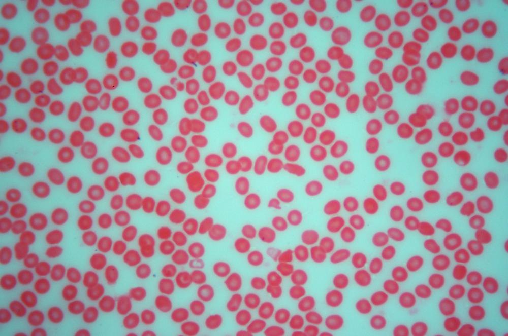 Human (Homo sapiens) blood sm, 400X