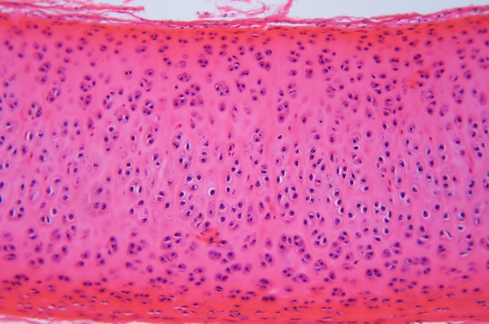 Boar (Sus scrofa) cartilage wm showing chondrocytes in lacunae, 100X