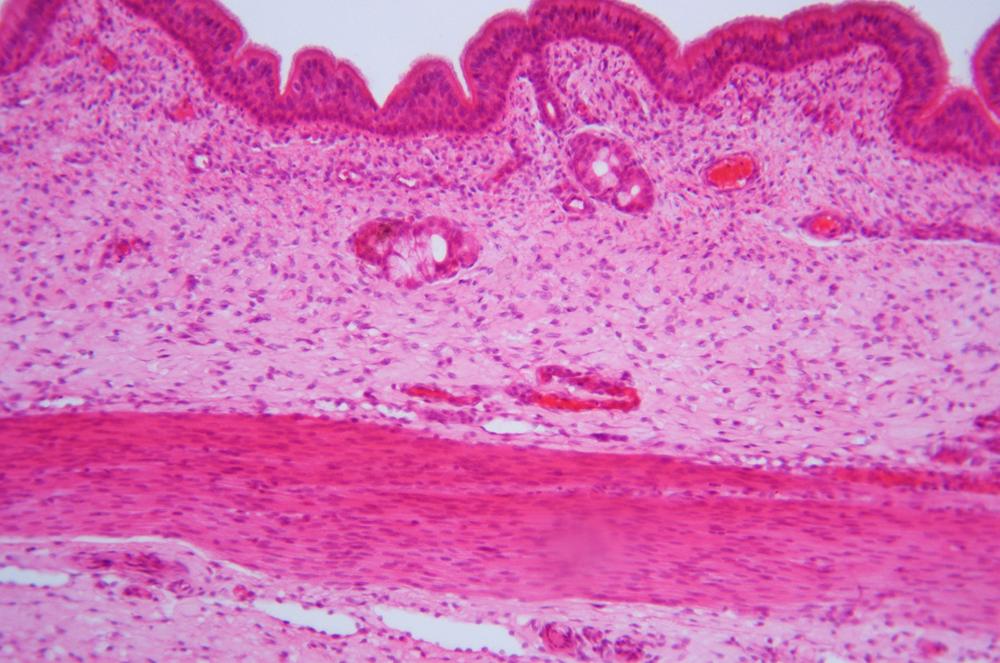 Hyaline cartilage sec, 100X