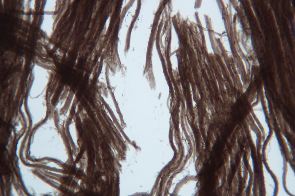 Dog (Canis lupus familiaris) teased skeletal (striated) muscle fibers wm, 100X