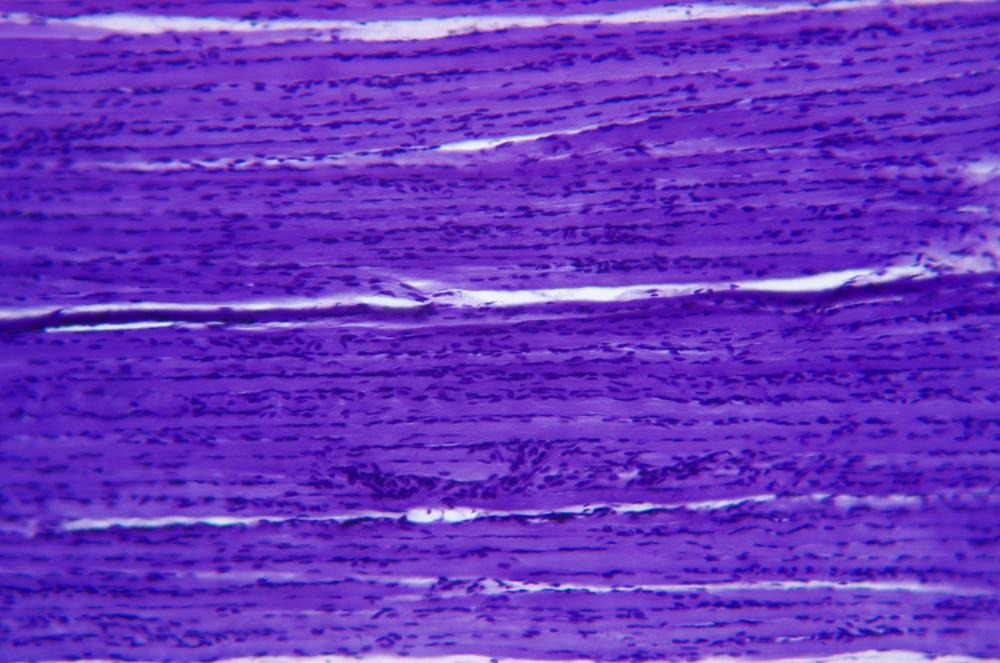 Skeletal (striated) muscle sec, 100X