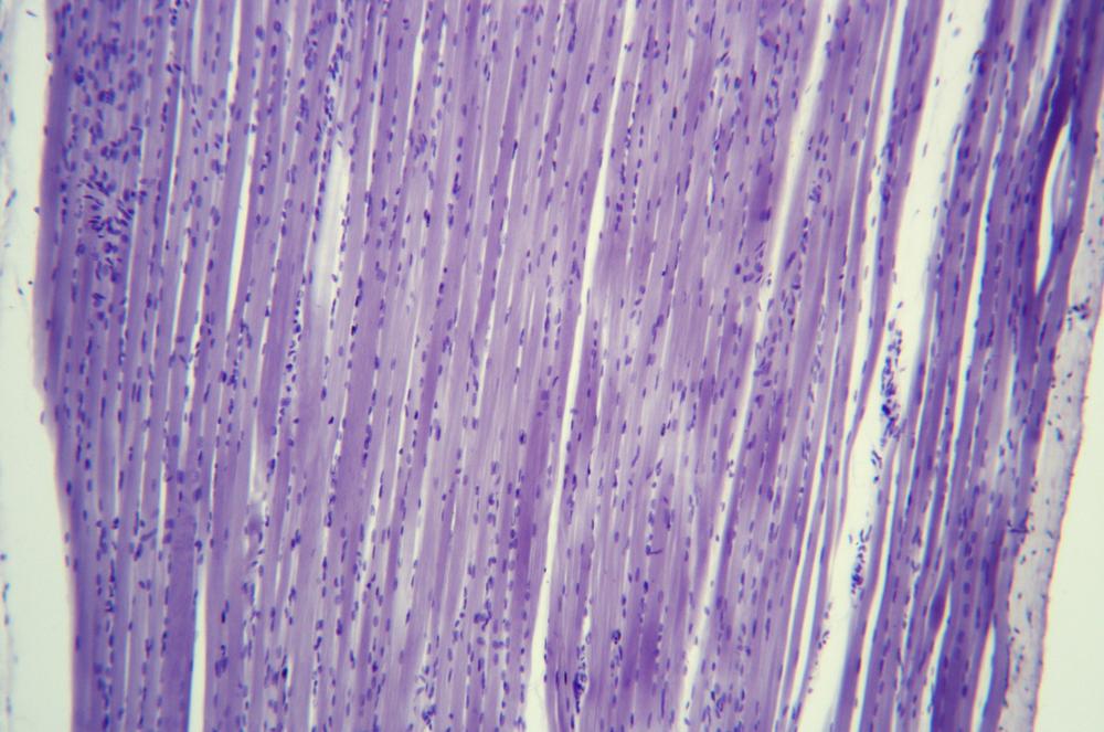 Striated skeletal muscle ls, 100X