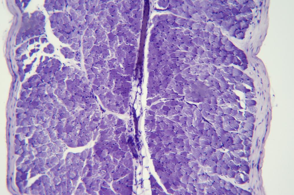 Striated skeletal muscle cs, 100X