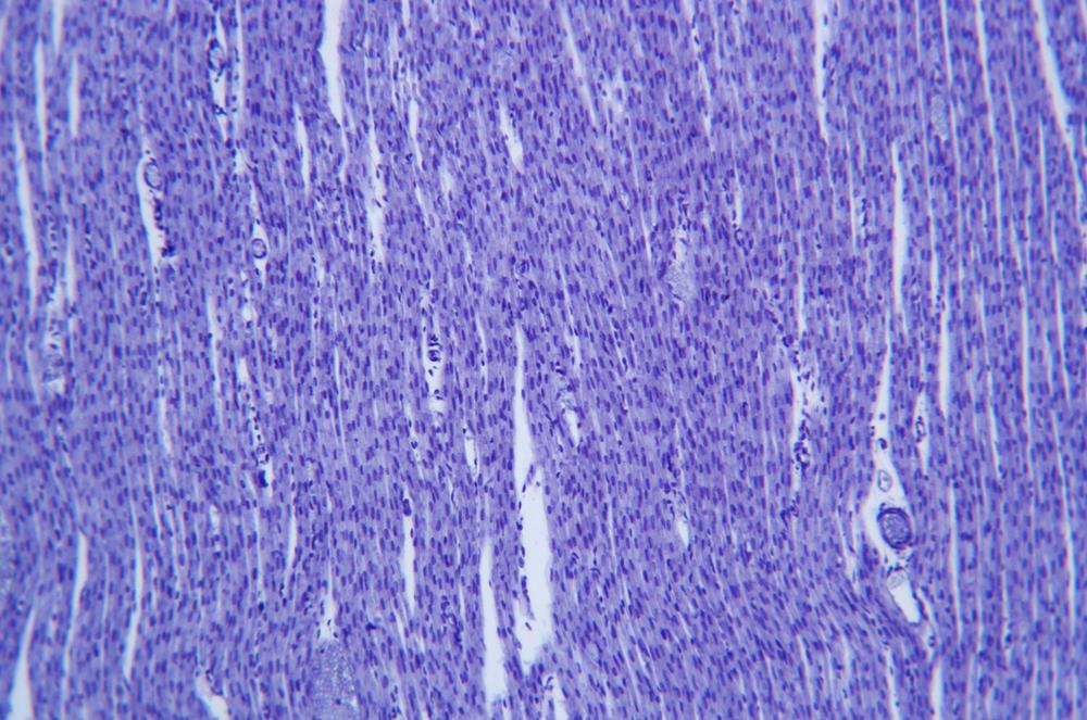 Human cardiac muscle sec, 100X