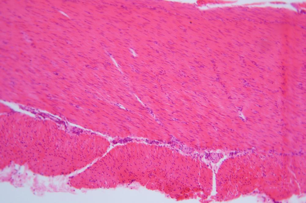 Smooth muscle sec, 100X