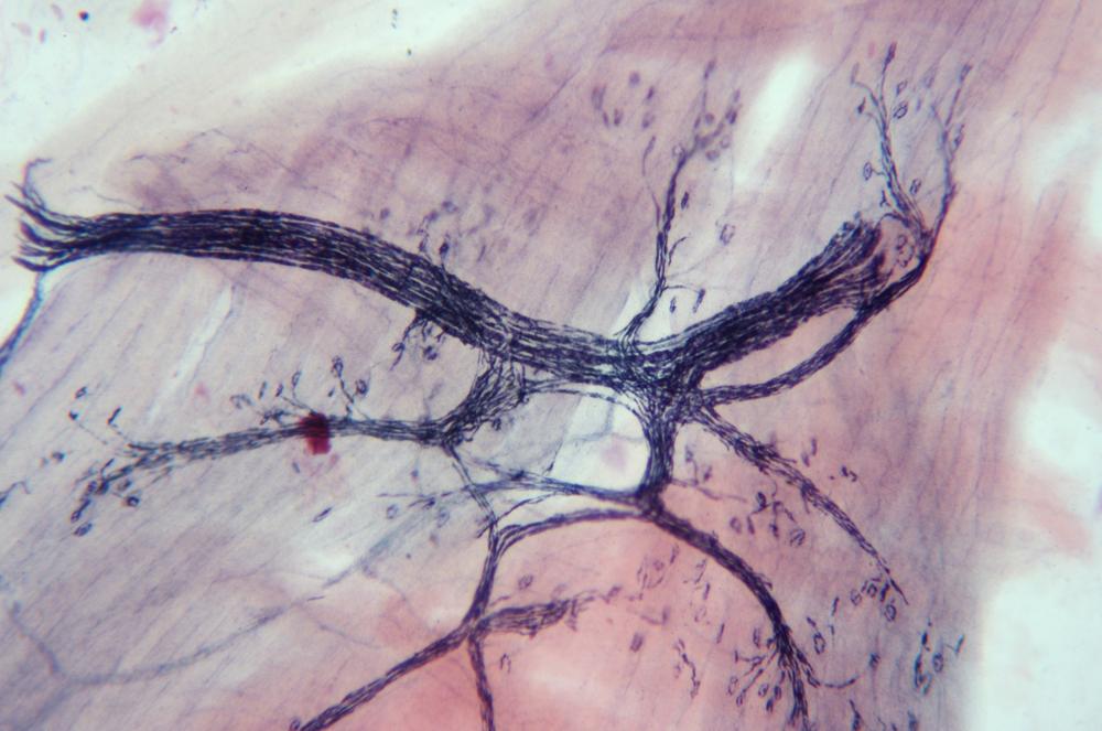 Pika (Ochotona sp.) motor nerve ending wm, 100X