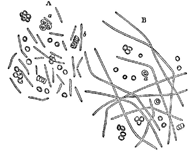 Fig. 7. Bacillus anthracis.