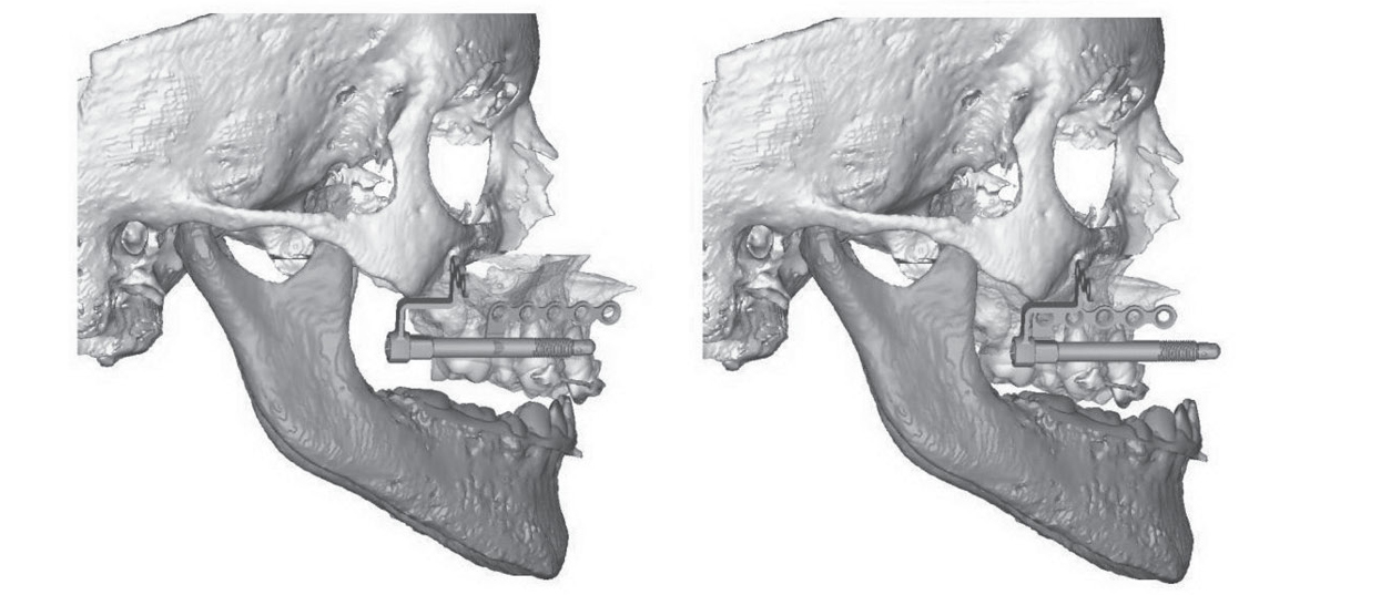 x-rays