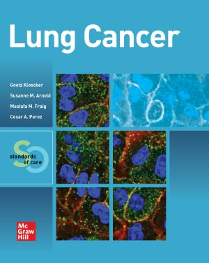 Lung Cancer: Standards of Care