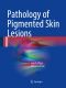 Pathology of Pigmented Skin Lesions