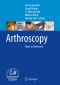 Arthroscopy