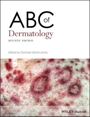 ABC of Dermatology, Seventh Edition