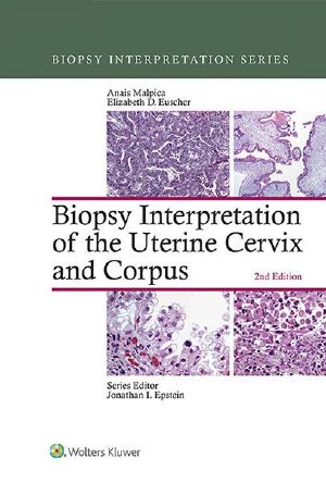 Biopsy Interpretation of the Uterine Cervix and Corpus