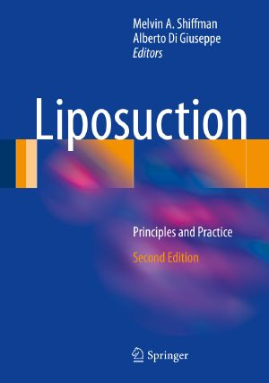 Liposuction