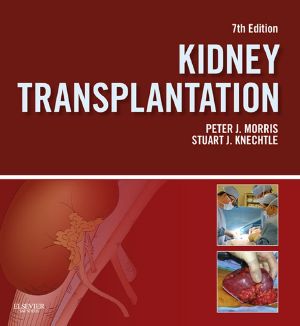 Kidney Transplantation · Principles and Practice