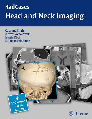 Head and Neck Imaging