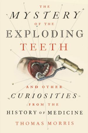 The Mystery of the Exploding Teeth, And Other Curiosities from the History of Medicine