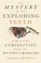 The Mystery of the Exploding Teeth, And Other Curiosities from the History of Medicine