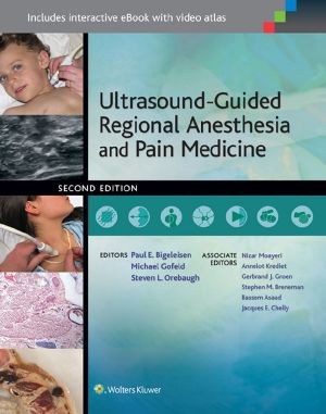 Ultrasound-Guided Regional Anesthesia and Pain Medicine